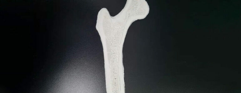 RAISE3D 3D Printing Enables Advanced Radiation Medical Treatment