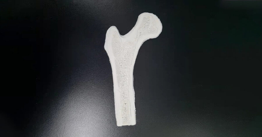RAISE3D 3D Printing Enables Advanced Radiation Medical Treatment